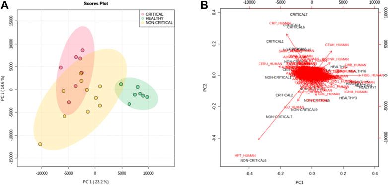 Főkomponens-elemzés. A PC1 és PC2 pontszámdiagramja (A) egyértelműen elkülöníti az egészséges alanyokat (zöld pontok) a kritikus COVID-19 betegektől (piros pontok) és a nem kritikus (sárga pontok) COVID-19 betegektől. (B) A PC1 és PC2 pontszámok (fekete) és a terhelés (piros) bi-plotja a betegség súlyossága és a fehérjék expressziója közötti korrelációról számolt be.